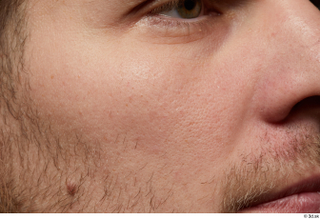 HD Arvid cheek face skin pores skin texture 0002.jpg